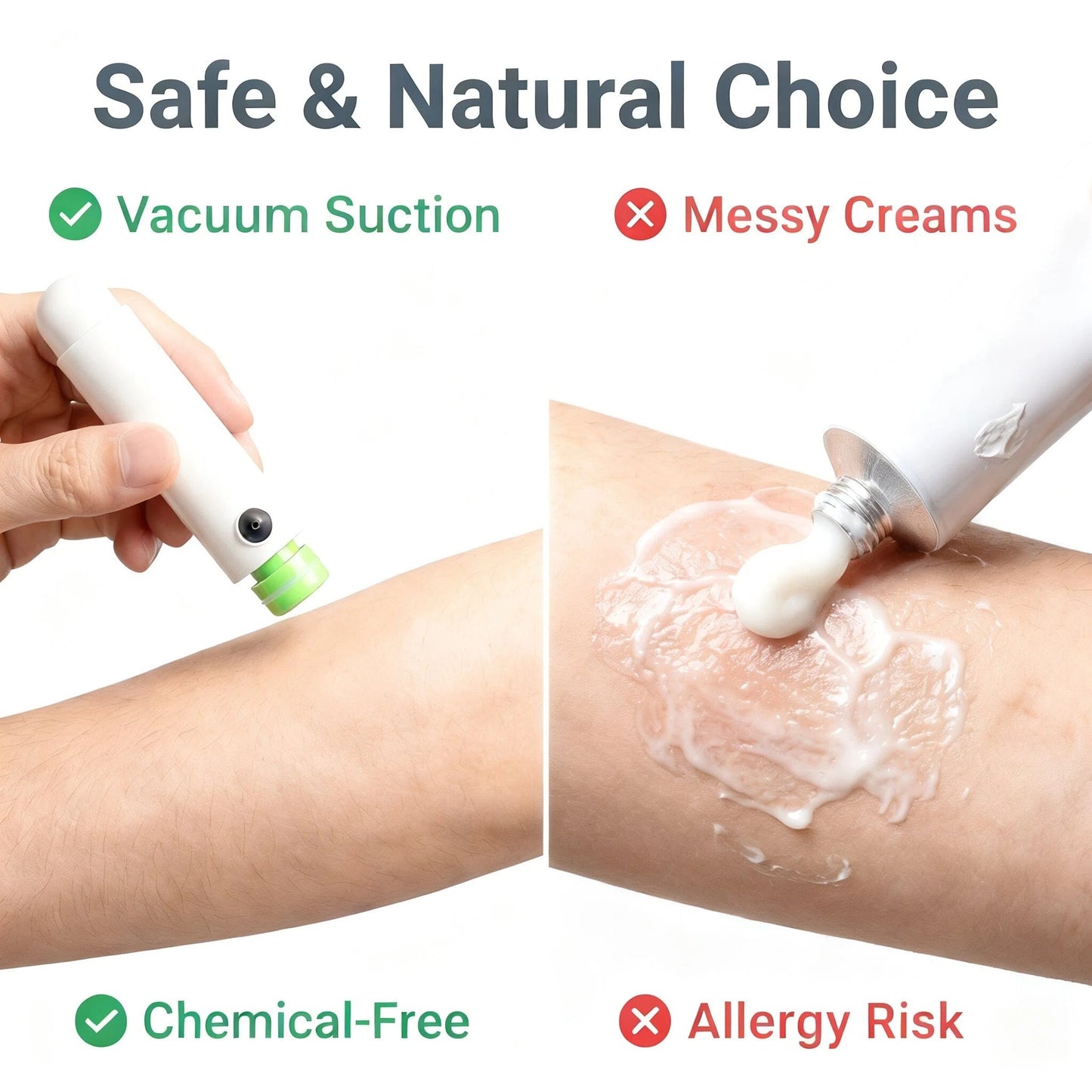 Vacubite – The Best Mosquito Bite Relief Device for Kids & Sensitive Skin | Chemical-Free Physical Anti-Itch Suction Tool
